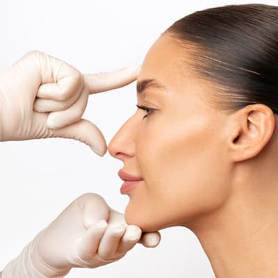 Rhinoplasty